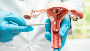 Un vistazo al futuro del tratamiento del cáncer ginecológico
